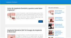Desktop Screenshot of implante-dentarios.com